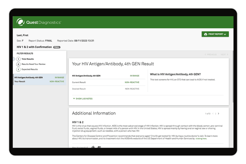 hiv-1-2-test-with-confirmation