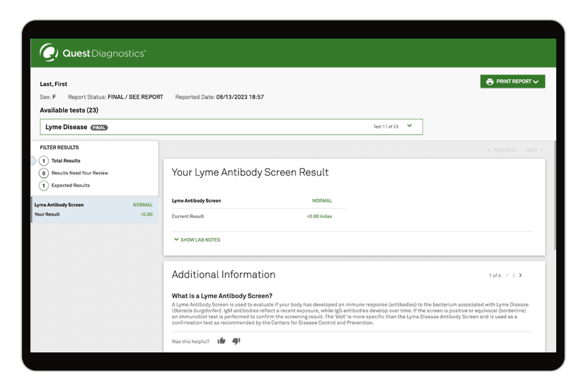 lyme-disease-test-with-confirmation