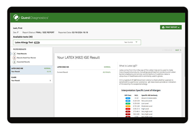 latex-allergy-test