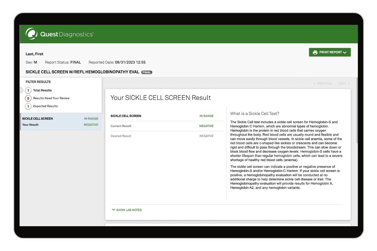 Sickle Cell Trait Screen Test with Reflex